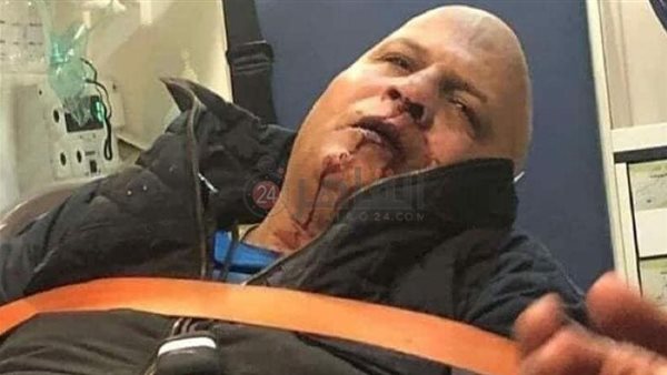 إصابة عادل شكل كبير