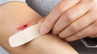 البطاطس والبطاطا الحلوة.. 5 أطعمة تساعد على علاج الجروح