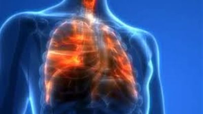 التدخين وغاز الرادون.. أهم أسباب الإصابة بسرطان الرئة