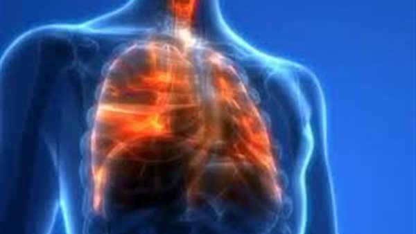 سرطان الرئة