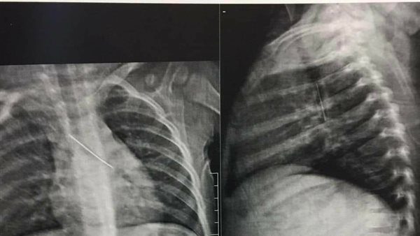 بنها الجامعى 