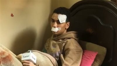 3 بلطجية يشوهون وجه طالب تعرض للسرقة في شبرا.. والضحية باكيا: مش ذنبي أخرج من الدرس وأخد 25 غرزة | بث مباشر 