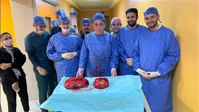 فريق طبي بمعهد جنوب مصر للأورام ينجح في استئصال ورم بالأمعاء يزن 20 كيلو 