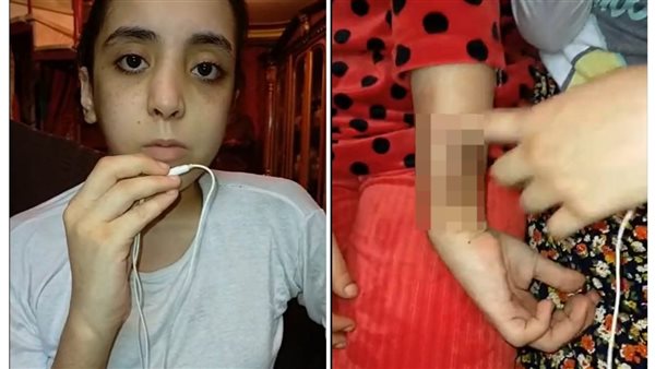 المجني عليهما 