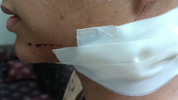 طالب المرج المجني