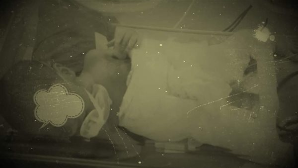 العملية الجراحية