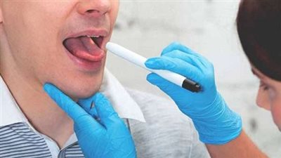 أبرزها جفاف اللسان.. علامات تظهر على الفم تشير إلى وجود مشاكل صحية