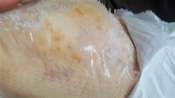 دواجن غير صالحة للاستهلاك