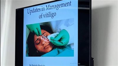 برنامج تدريبي لأطباء الجلدية بمنشآت هيئة الرعاية الصحية بمحافظة بورسعيد | صور