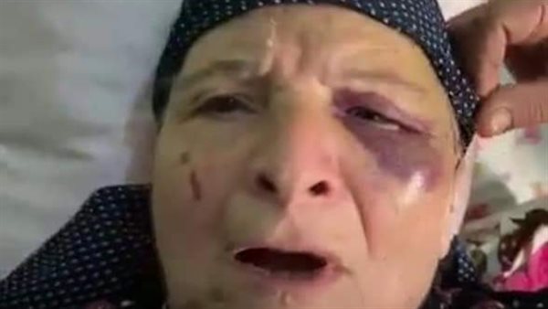 السيدة المعتدي عليها