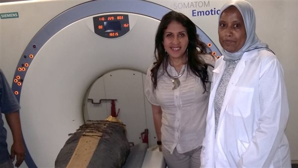 الأشعة المقطعية تكشف