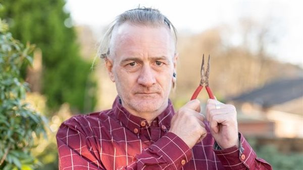 رجل يخلع أسنانه بنفسه