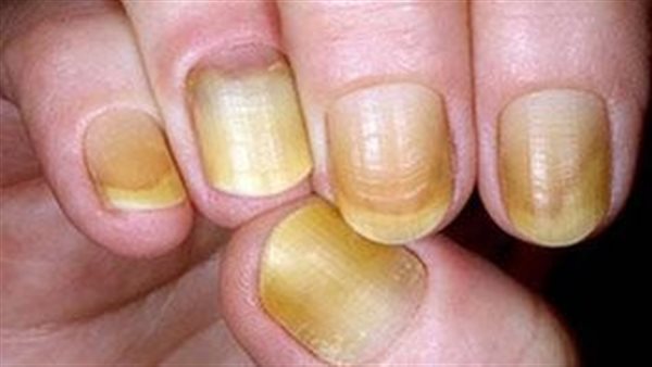 لون الأظافر 