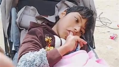 جدة طفلة تعاني من شلل جزئي تستغيث: أنا اللي بعملّها كل حاجة ونفسي تتعالج | بث مباشر