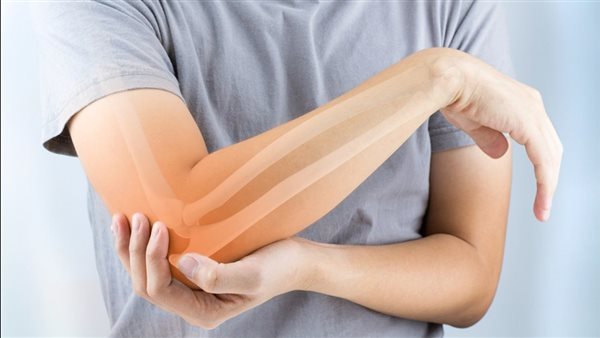 التهاب المفاصل