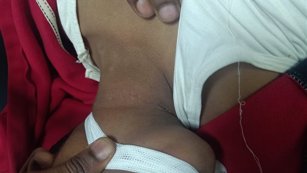 الطفل المعثور عليه