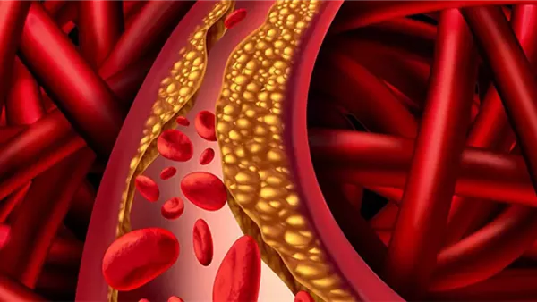 الكوليسترول في الدم