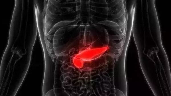 سرطان البنكرياس 