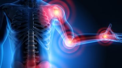 في يومه العالمي.. 4 خرافات شائعة حول التهاب المفاصل  