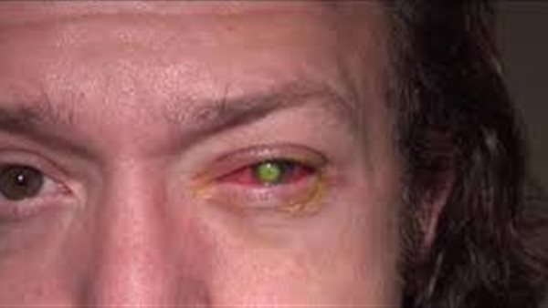 الأمريكي تشاد جروشين