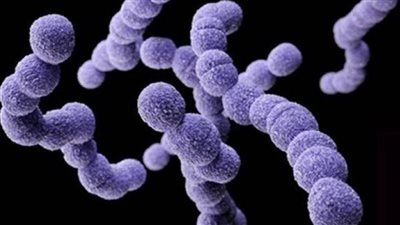 تعرف على أبرز مضاعفات الإصابة بعدوى البكتيريا أ