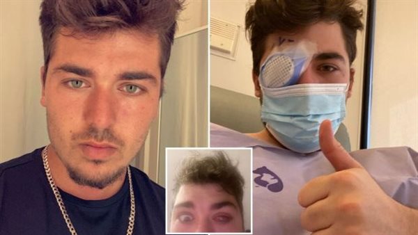 مايك كرومهولز