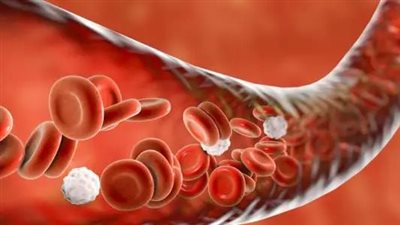 أعراض وطرق علاج نقص الحديد.. تعرف عليها  