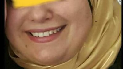 تفاصيل إصابة ربة منزل  بمياه نار في التجمع