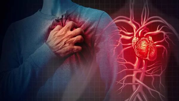 نوبة قلبية ـ تعبيرية