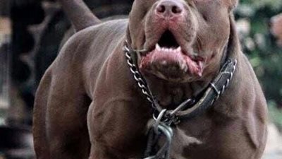 زوجة المصاب في هجوم كلب الـ بيتبول: زوجي في غيبوبة من الإثنين الماضي حتى الآن