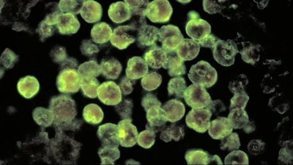  الأميبا أكلة الدماغ