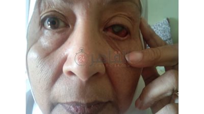 الدكتور قالي لازم نشيل عينك.. سيدة تتعرض لإهمال طبي: عملت 5 عمليات غلط وطلعت بموت