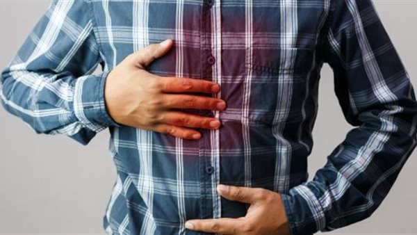 حموضة المعدة