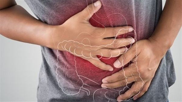  متلازمة القولون