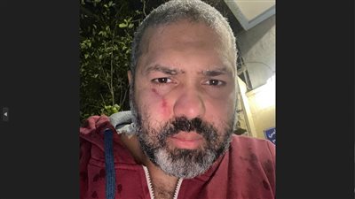 تصالح الملحن محمود الخيامي مع المتهمين بالتعدي عليه بحدائق الأهرام