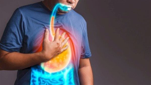 ارتجاع المريئ