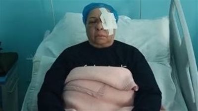 بسبب مشاجرة بين أهالي المنطقة.. سيدة تفقد عينها اليسرى بطلق خرطوش في حدائق القبة | بث مباشر 