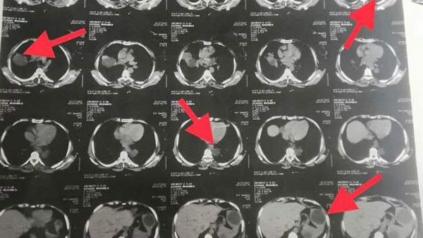 مستشفي بنها الجامعي