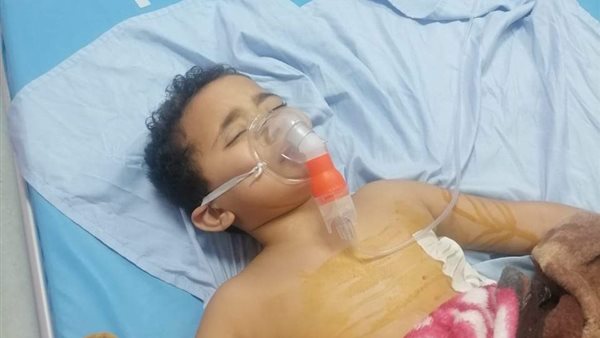 الطفل سيف المصاب