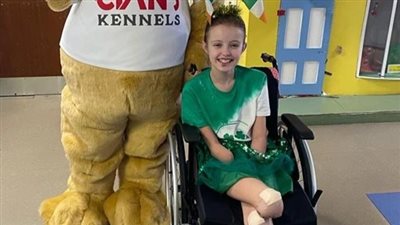 أصابتها بتعفن الأنسجة.. عدوى بكتيرية تتسبب في قطع الأطراف الأربعة لصغيرة