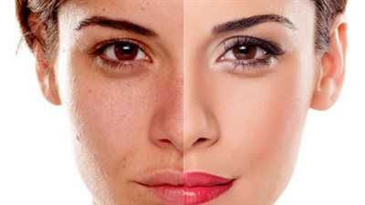 أبرزها مرق العظام.. 8 أطعمة تساهم في تعزيز الكولاجين