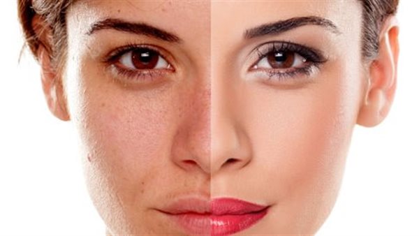 صحة البشرة ـ أرشيفية